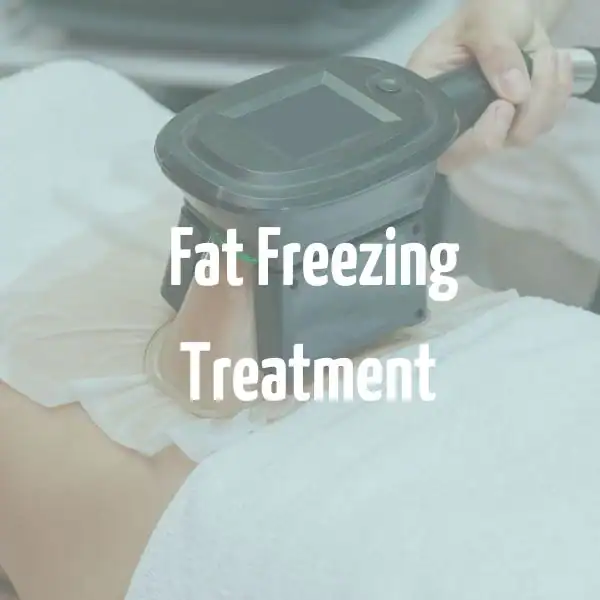 fat freezing treatment Loughborough