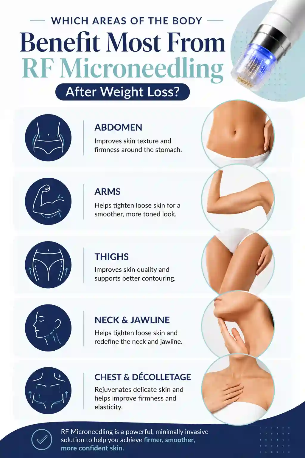 Which Areas of the Body Benefit Most From RF Microneedling After Weight Loss Loughborough